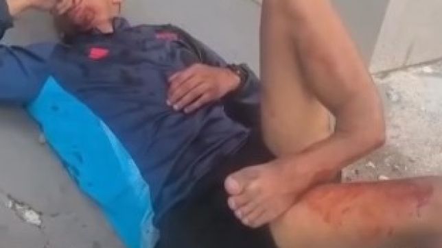 Vídeo: suspeitos são baleados após tentativa de roubo a policial militar de folga no Rio