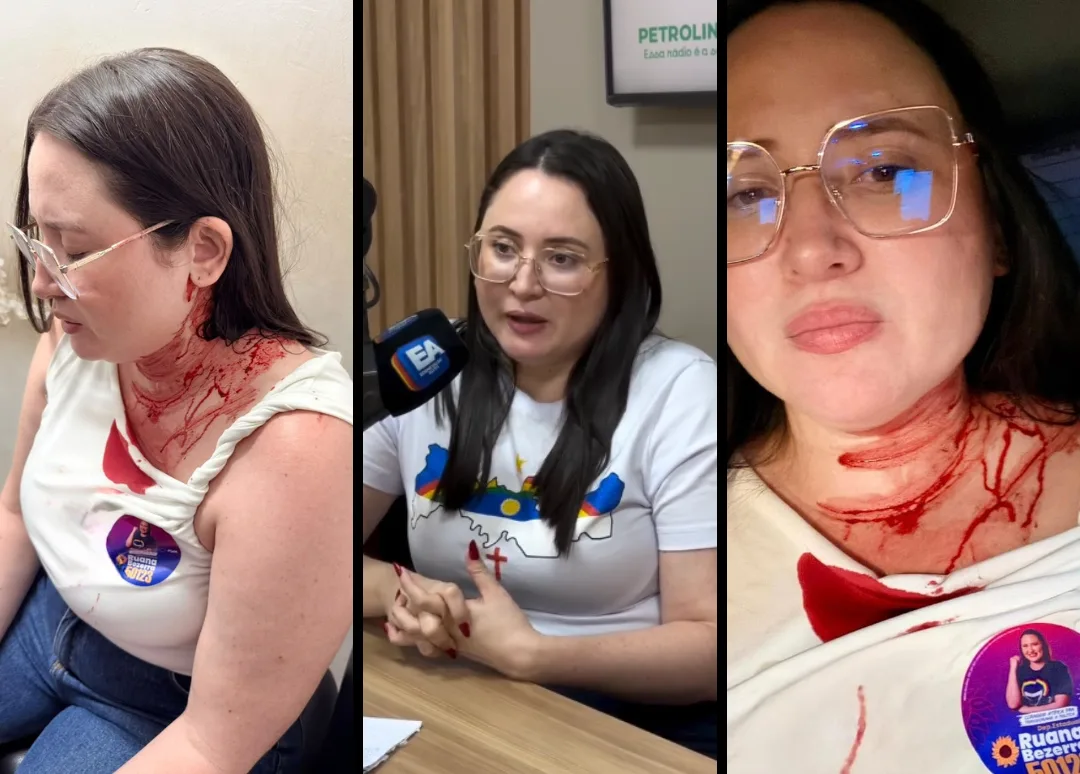 Imagem relacionada à reportagem Candidata do Psol leva pedrada na cabeça durante caminhada no Sertão pernambucano